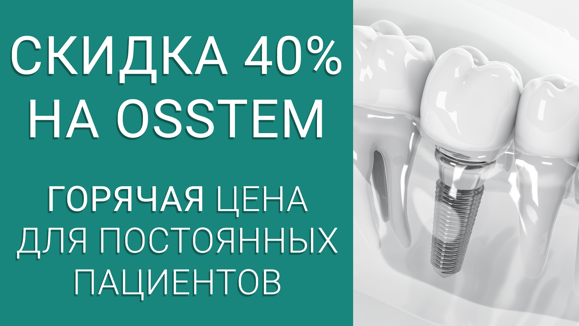 Имплантат Osstem со скидкой 40%!